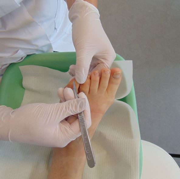 Medisch pedicure 2025